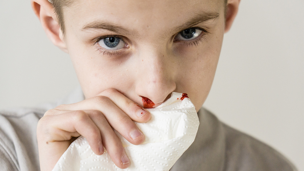 小孩流鼻血什么原因造成的